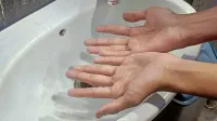 Jangan Sepelekan Cuci Tangan, Ini Pentingnya bagi Kesehatan