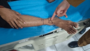 Digigit Ular Hitam Saat Pulang Pengajian, Warga Poncol Dirawat di RSUD Kraton Pekalongan